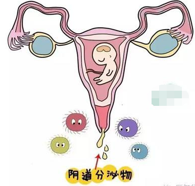阴道分泌物香蕉国产精品的一般性状检查类型
