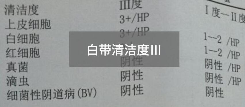 今天快讯！全自动白带成人香蕉网站入口生产厂家香蕉视频免费看为您官方解释白带清洁度3的意思