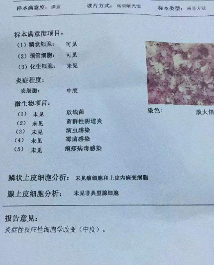 阴道分泌物香蕉国产精品厂家教你查看阴道分泌物检测报告