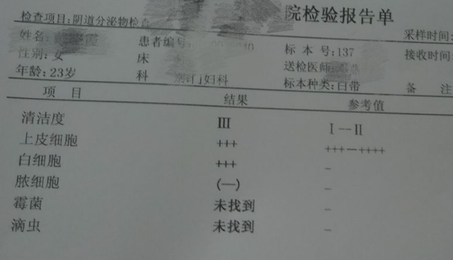 白带成人香蕉网站入口厂家教您看懂白带检验单
