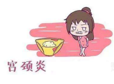 妇科白带香蕉国产精品厂家分析宫颈炎的症状